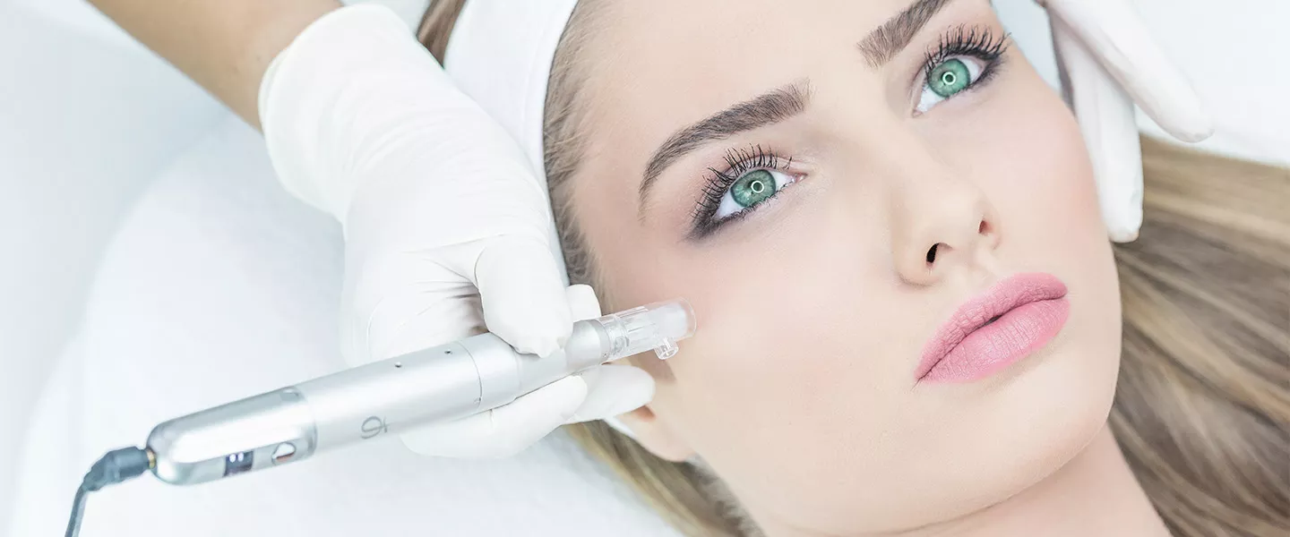 Ihr ultimativer Leitfaden zum Microneedling